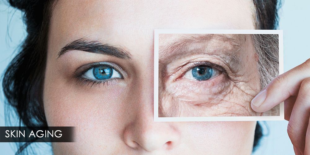 Skin Aging